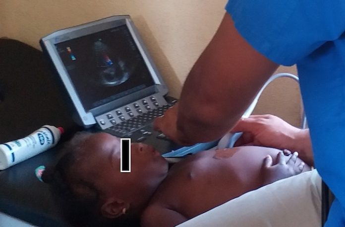 Geslaagde kinderhartmissie van Medische Zending in Boven-Suriname