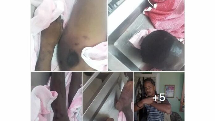 Broer van overleden gedetineerde deelt foto's van lijk die mishandeling aantonen