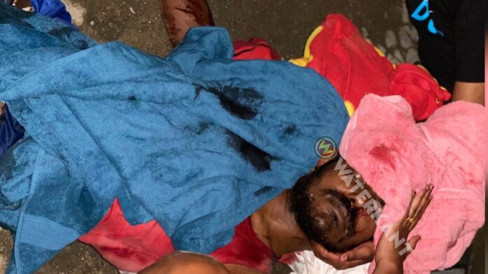 Guyanese man in Suriname gewond aan hoofd na vechtpartij