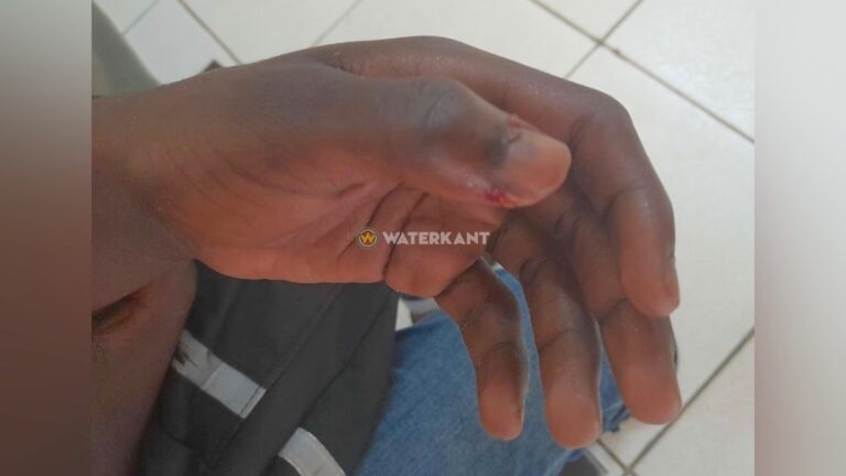 Klasgenoot bijt duim medeleerling tijdens vechtpartij