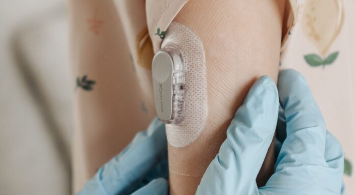 glucosesensor